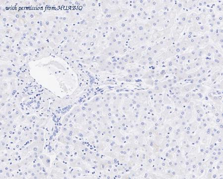 HUABIO HA721819 image 3