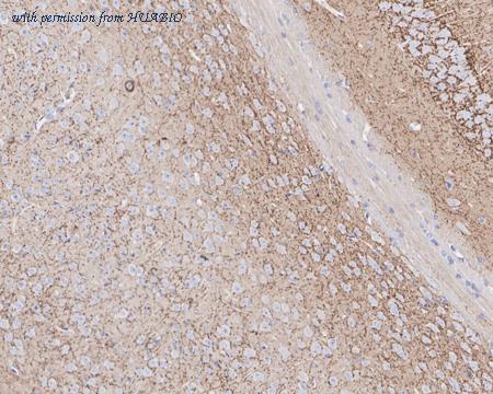 HUABIO HA721820 image 2