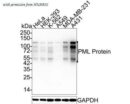 HUABIO HA721846 image 1