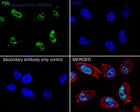 HUABIO HA721846 image 3