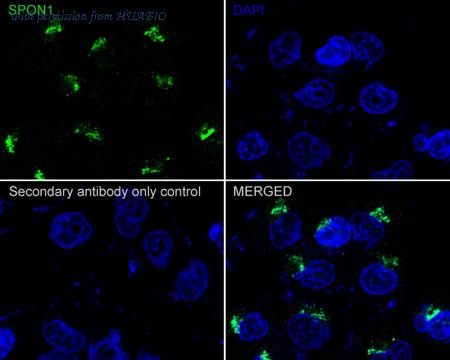 HUABIO HA721863 image 2