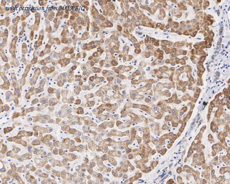 HUABIO HA721872 image 3