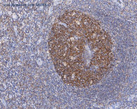 HUABIO HA721873 image 3