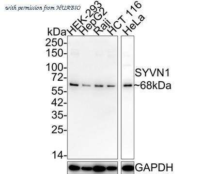 HUABIO HA721874 image 1