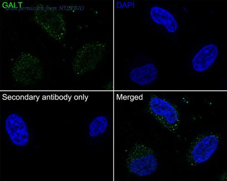 HUABIO HA721875 image 3