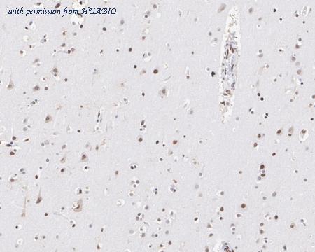 HUABIO HA721877 image 3