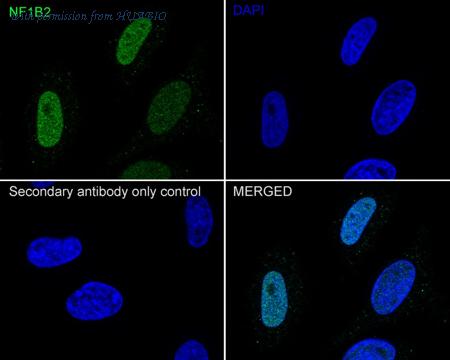 HUABIO HA721879 image 2