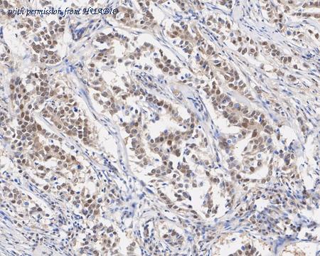 HUABIO HA721885 image 2