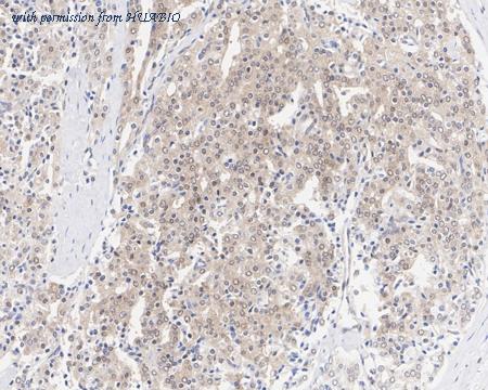 HUABIO HA721885 image 3