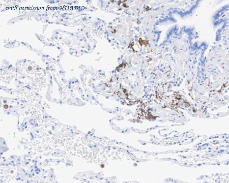 HUABIO HA721897 image 2