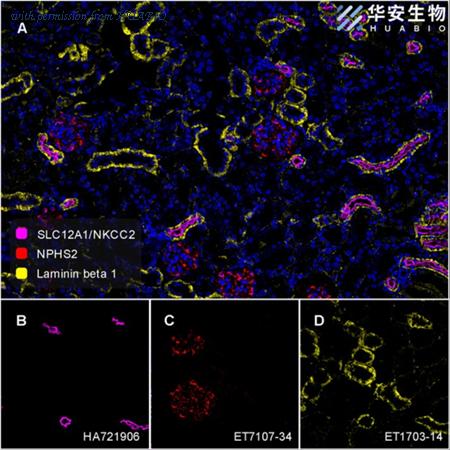 HUABIO HA721906 image 3