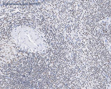 HUABIO HA721908 image 3