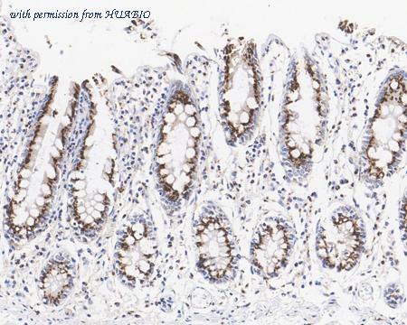 HUABIO HA721917 image 3