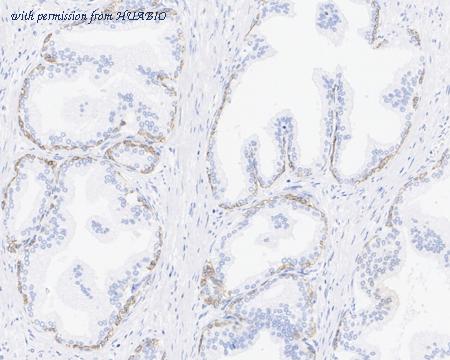 HUABIO HA721918 image 2