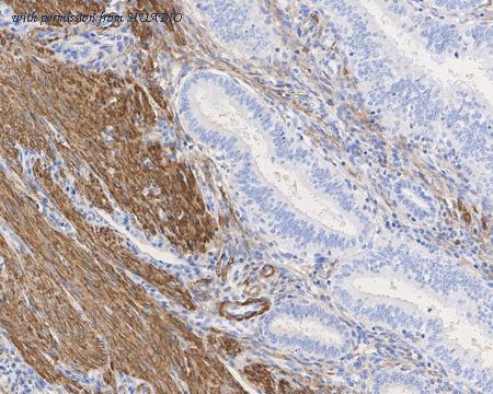 HUABIO HA721928 image 2