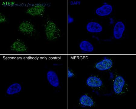 HUABIO HA721947 image 2