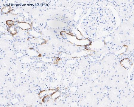 HUABIO HA721954 image 2