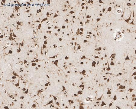 HUABIO HA721961 image 3