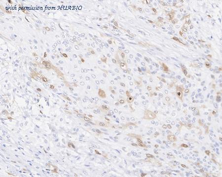 HUABIO HA721987 image 2