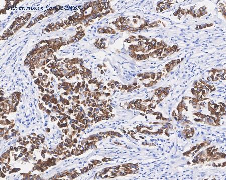 HUABIO HA721994 image 3