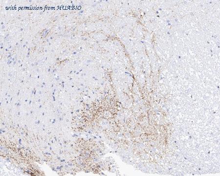 HUABIO HA721995 image 1