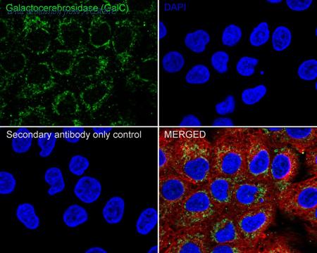 HUABIO HA722004 image 2