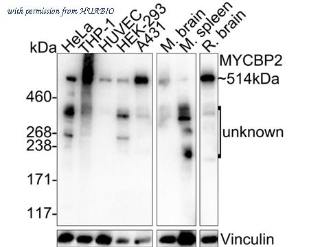 HUABIO HA722030 image 1