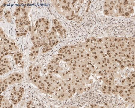 HUABIO HA722037 image 3