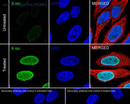 HUABIO HA722038 image 2