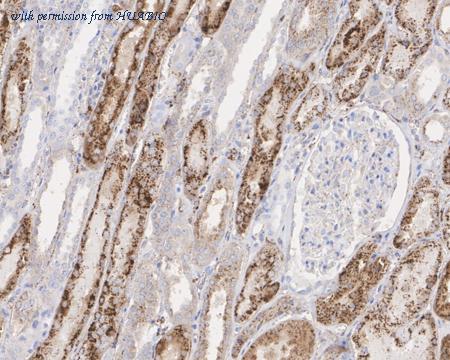 HUABIO HA722063 image 2