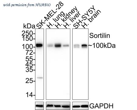 HUABIO HA722070 image 1