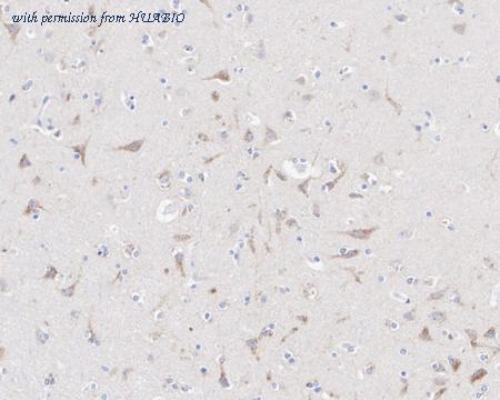 HUABIO HA722070 image 2