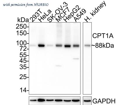 HUABIO HA722081 image 1