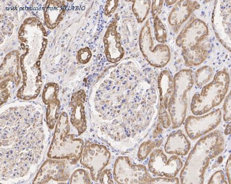 HUABIO HA722081 image 2