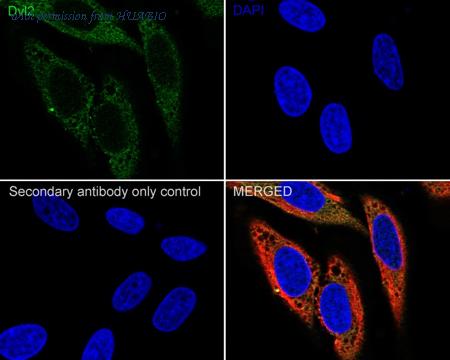 HUABIO HA722088 image 2