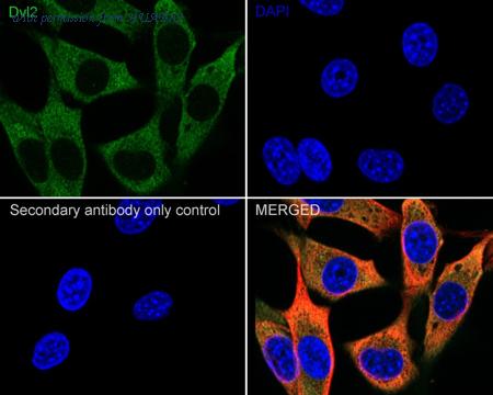 HUABIO HA722088 image 3