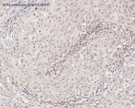 HUABIO HA722089 image 3