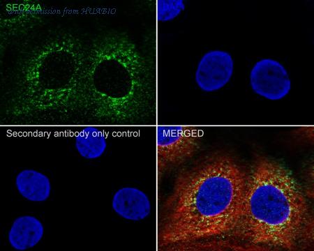 HUABIO HA722119 image 2