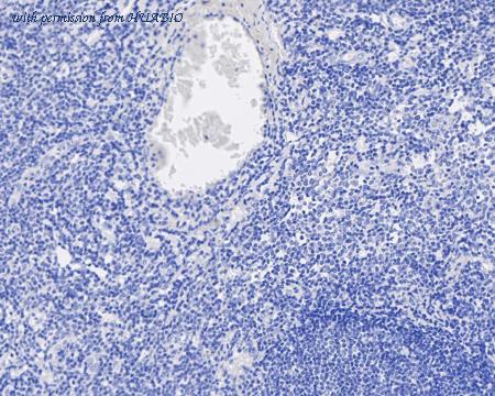 HUABIO HA722122 image 2