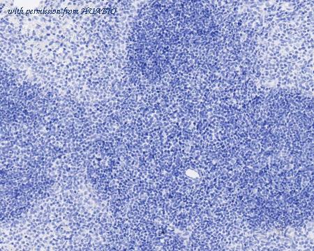 HUABIO HA722122 image 3