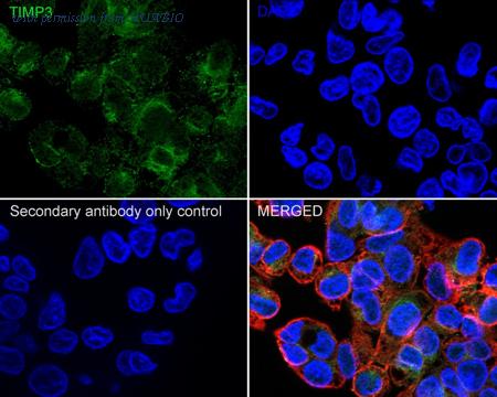 HUABIO HA722126 image 3