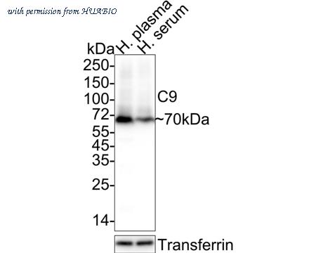 HUABIO HA722136 image 1