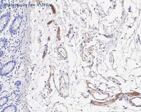 HUABIO HA722136 image 2