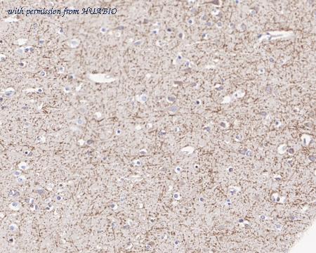 HUABIO HA722139 image 3