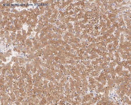 HUABIO HA722155 image 2