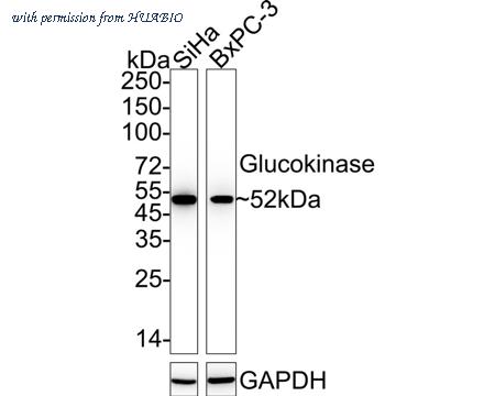 HUABIO HA722204 image 1