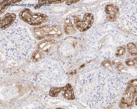 HUABIO HA722214 image 2