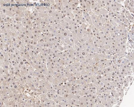 HUABIO HA722215 image 3