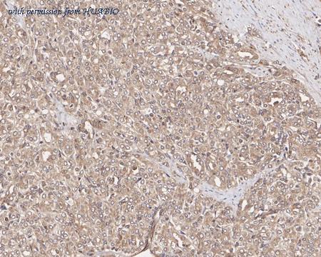 HUABIO HA722226 image 3