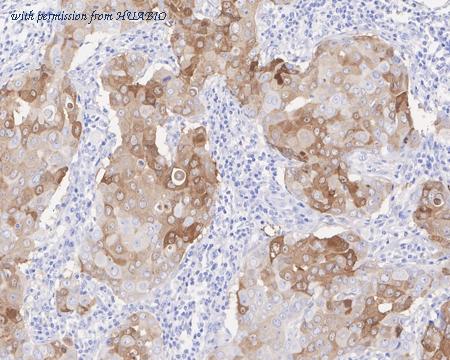 HUABIO HA722241 image 2